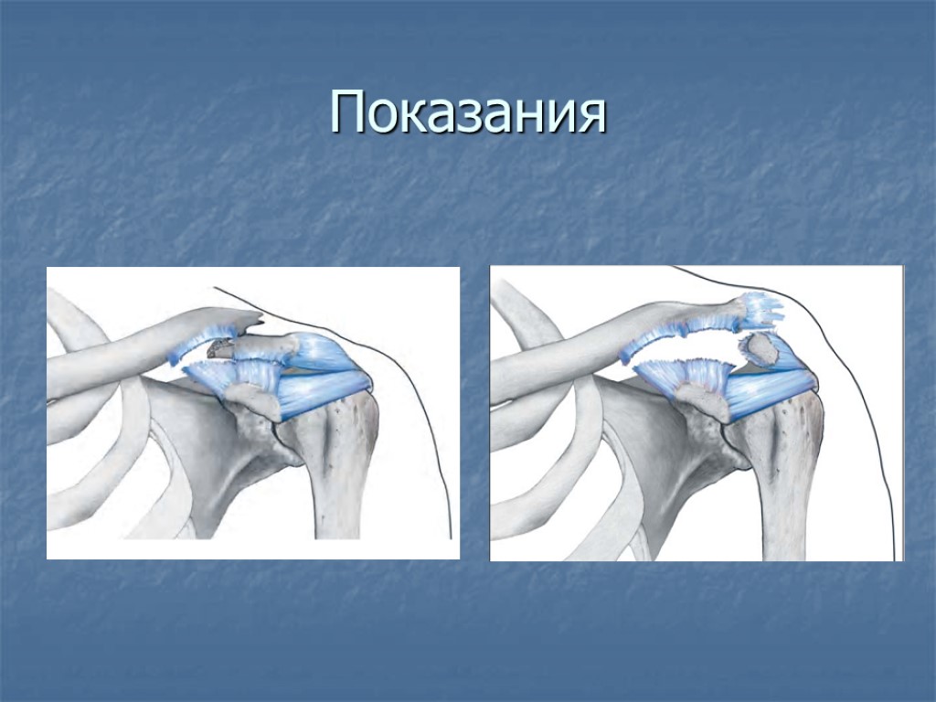 Показания